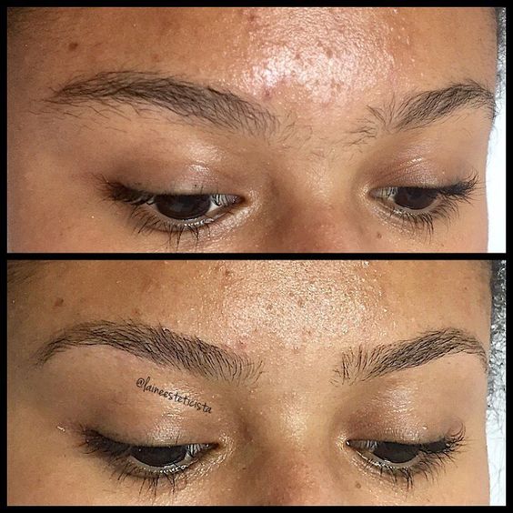 Design de sobrancelhas #designerdesobrancelhas #esteticista #micropigmentadora #estética #micropigmentação #beleza #sobrancelhasperfeitas #transformandoolhares  #micropigmentation  #microblading #pmu #masterclass #fiosesombreado #eyebrows #beauty #beautician #aesthetic http://ameritrustshield.com/ipost/1549564967161558386/?code=BWBKSCwDfVy